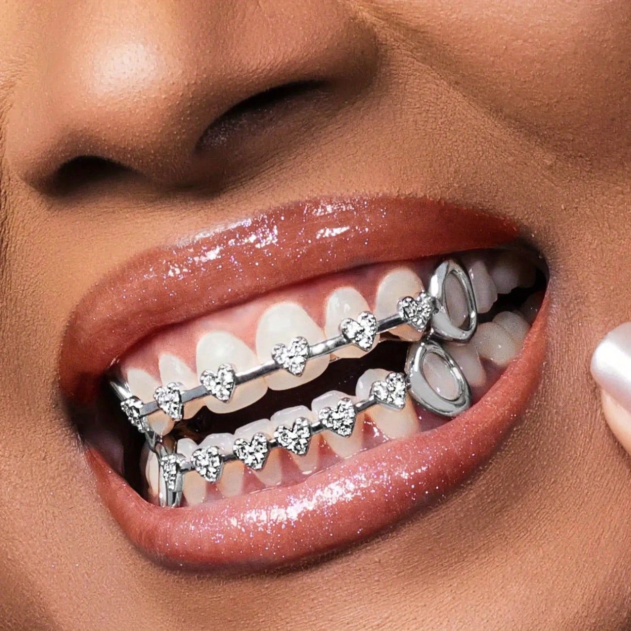 Street Fashion Types - Dientes de Oro de Moda Hip-Hop